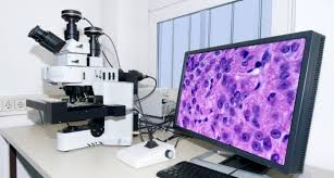 Picture of prostate histopathology
